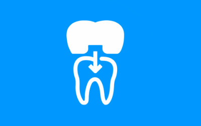 ПРОТЕЗИРОВАНИЕ ЗУБОВ